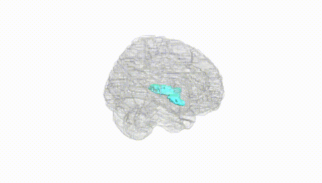 Full Brain White