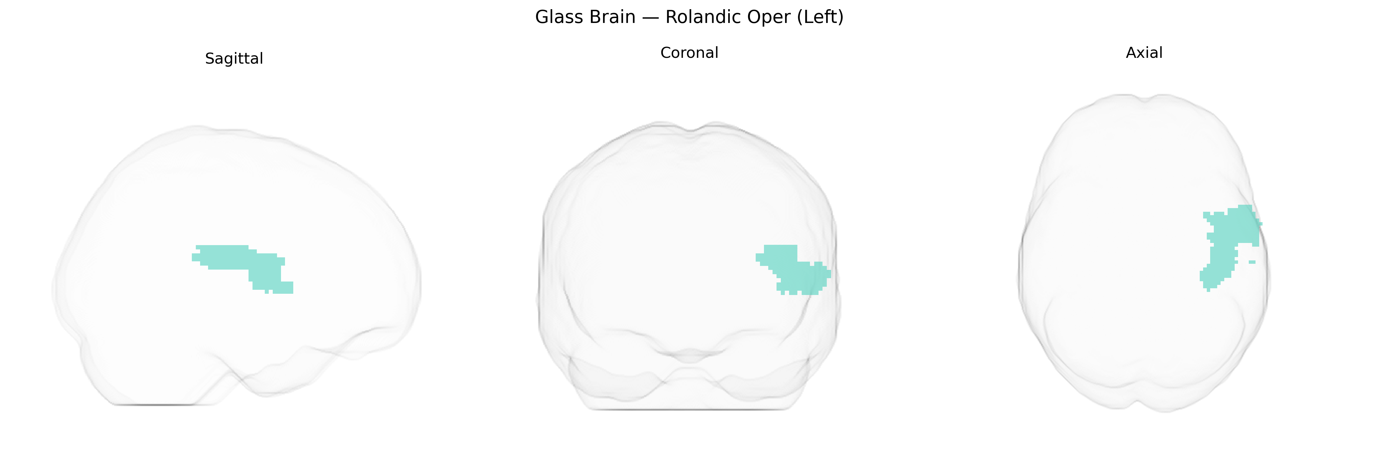 Triplanar Ghost Brain