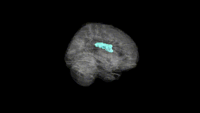 Full Brain Black