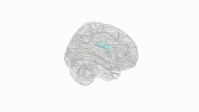 Full Brain White