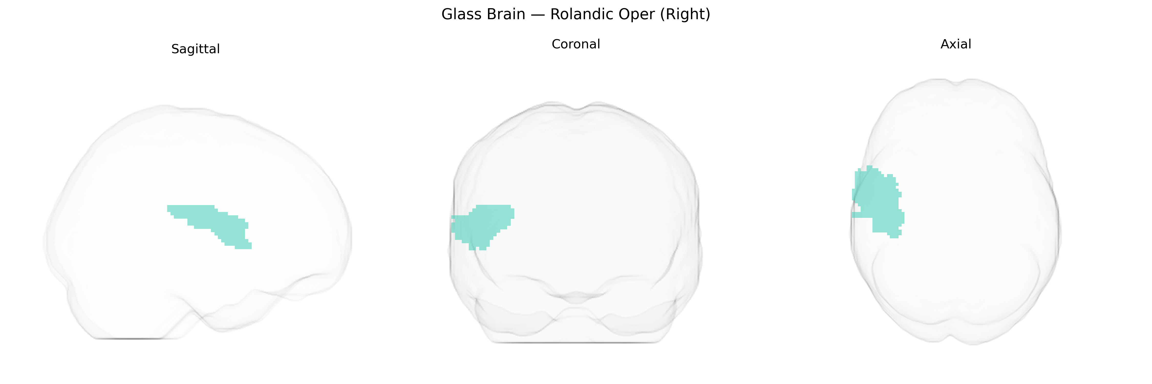 Triplanar Ghost Brain