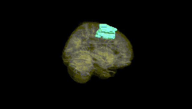 Full Brain Black