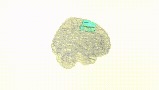 Full Brain White