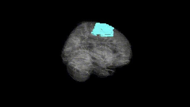 Full Brain Black