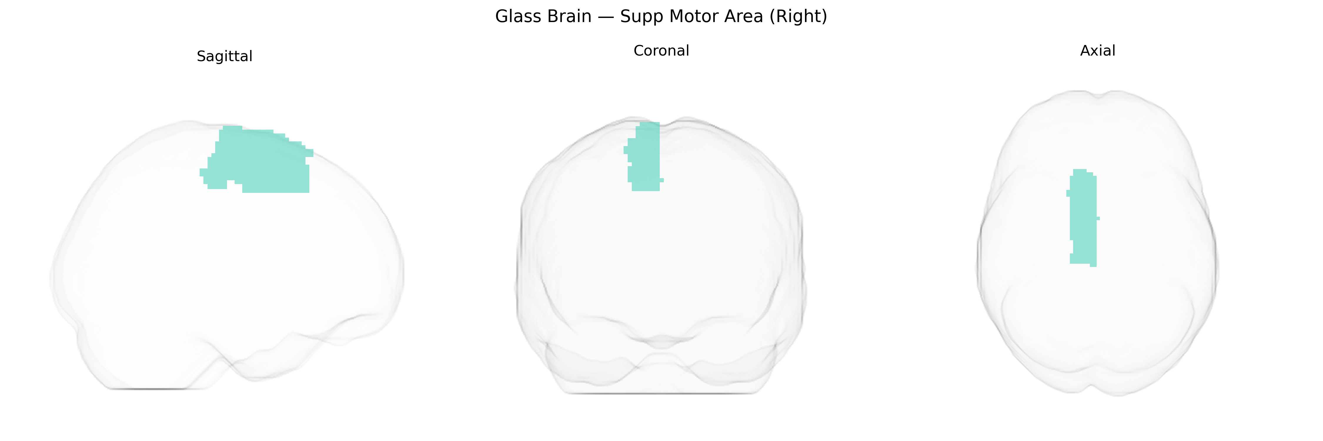 Triplanar Ghost Brain