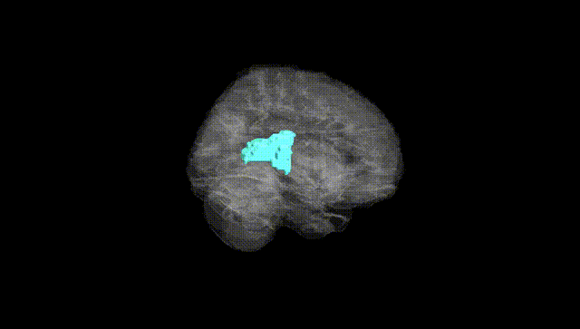 Full Brain Black