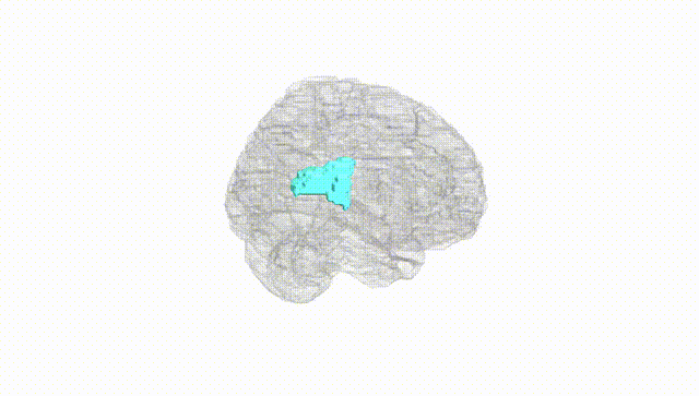 Full Brain White