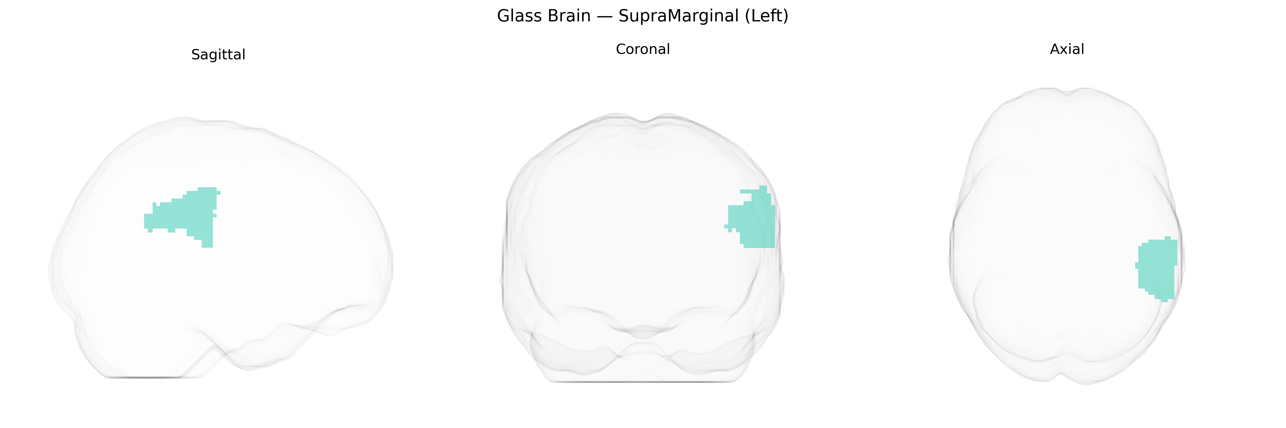 Triplanar Ghost Brain