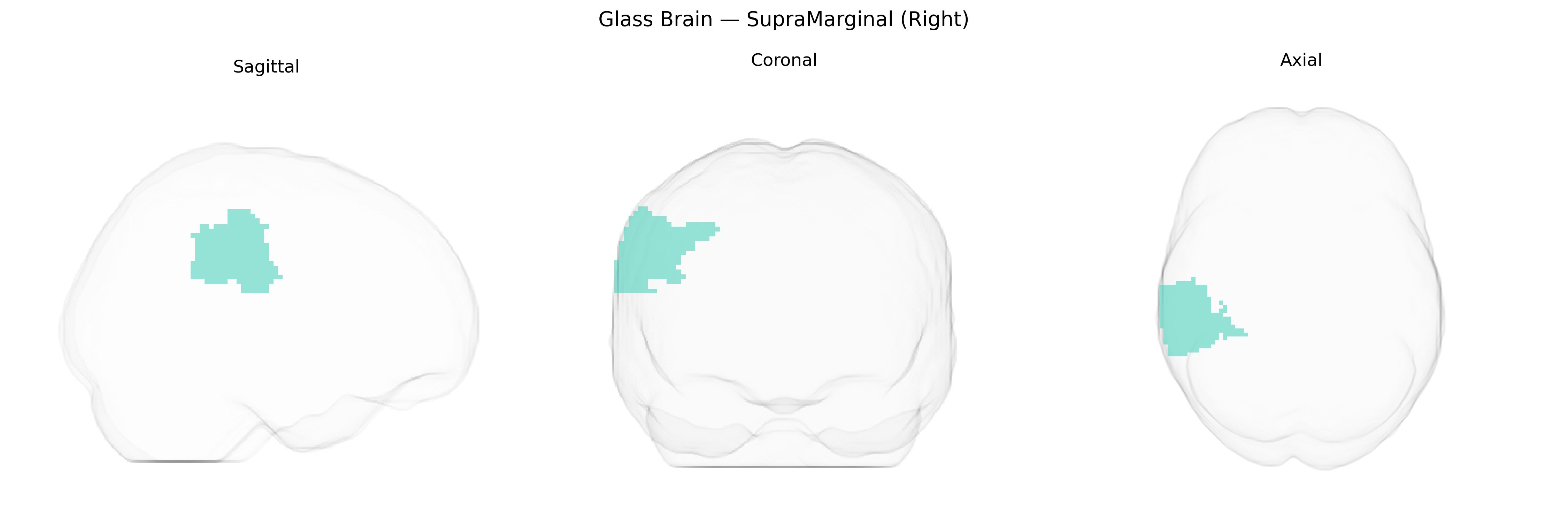 Triplanar Ghost Brain