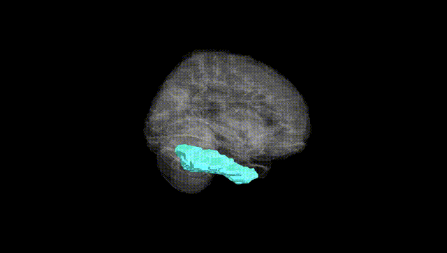 Full Brain Black