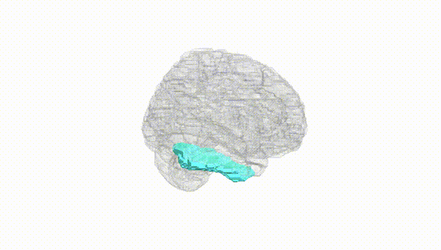 Full Brain White