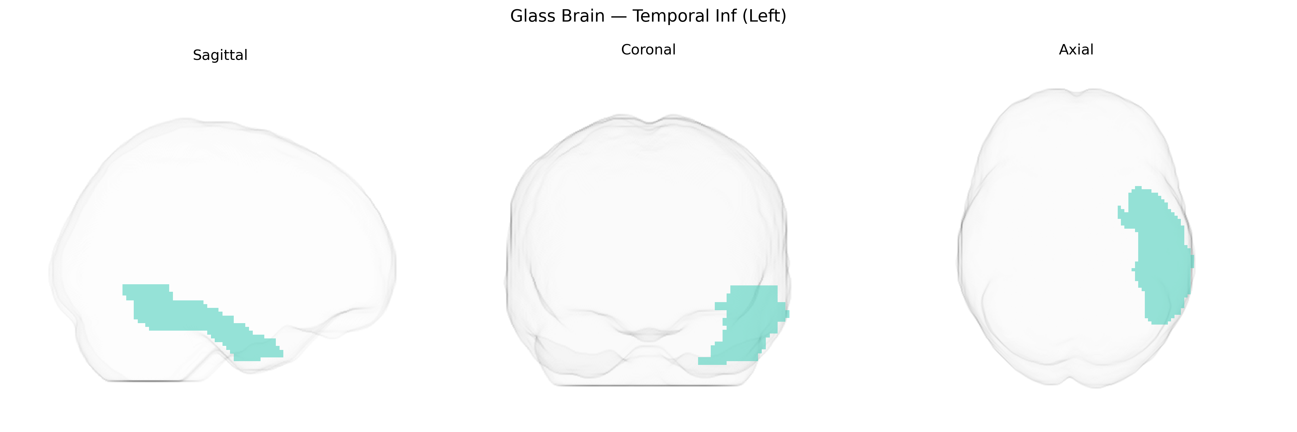 Triplanar Ghost Brain