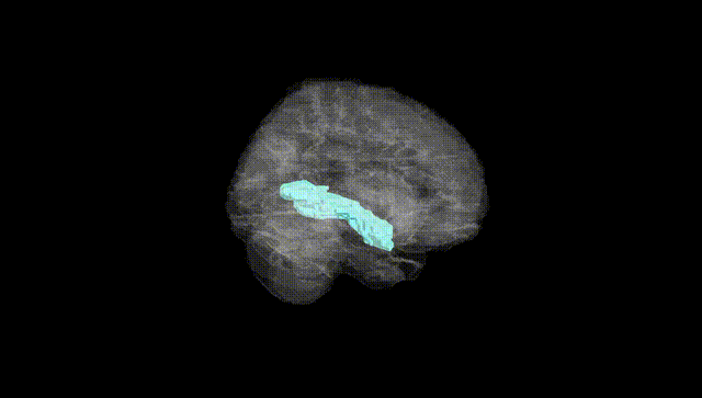 Full Brain Black