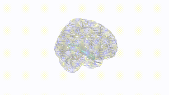 Full Brain White