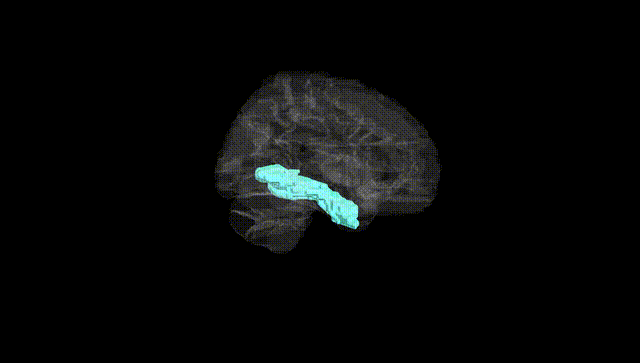 Hemisphere Black