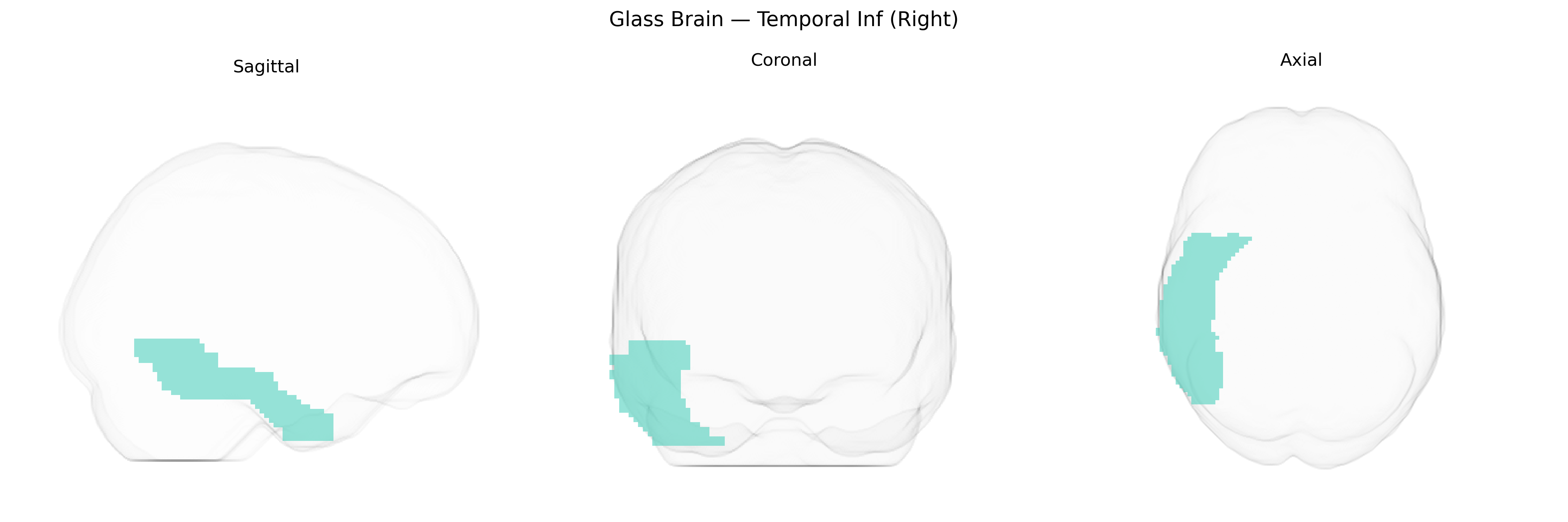 Triplanar Ghost Brain
