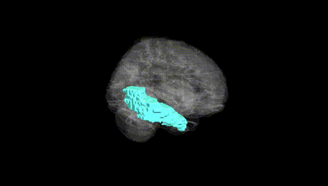Full Brain Black