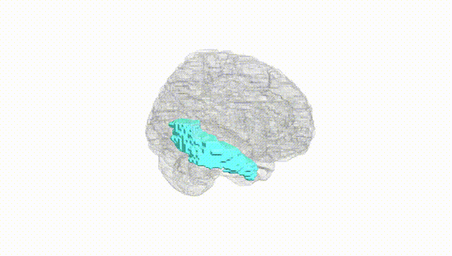 Full Brain White