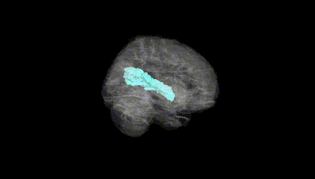 Full Brain Black