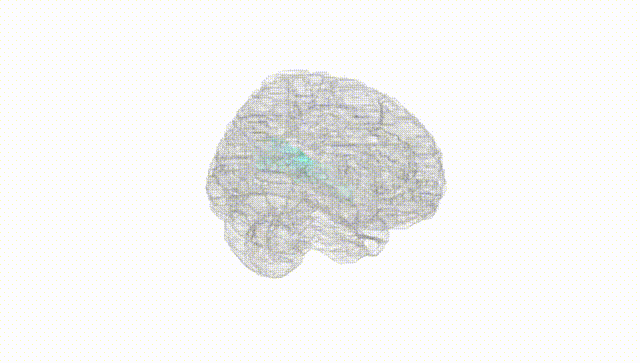 Full Brain White