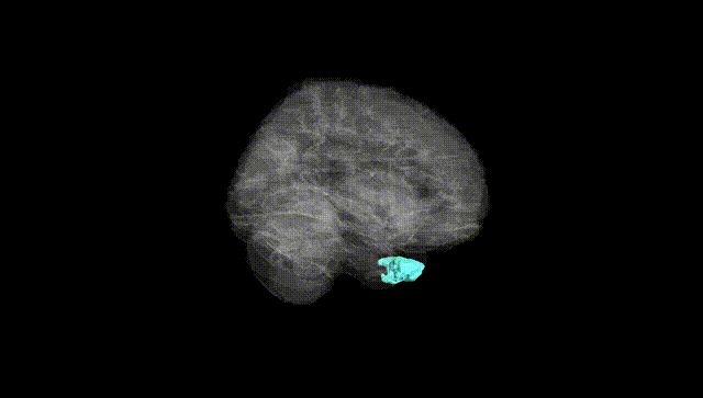 Full Brain Black