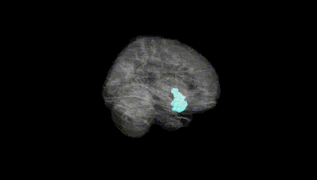 Full Brain Black