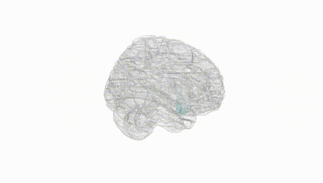 Full Brain White