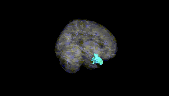 Full Brain Black