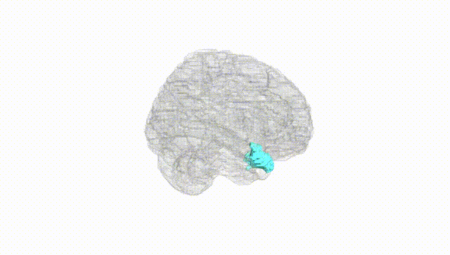 Full Brain White