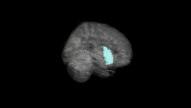 Full Brain Black