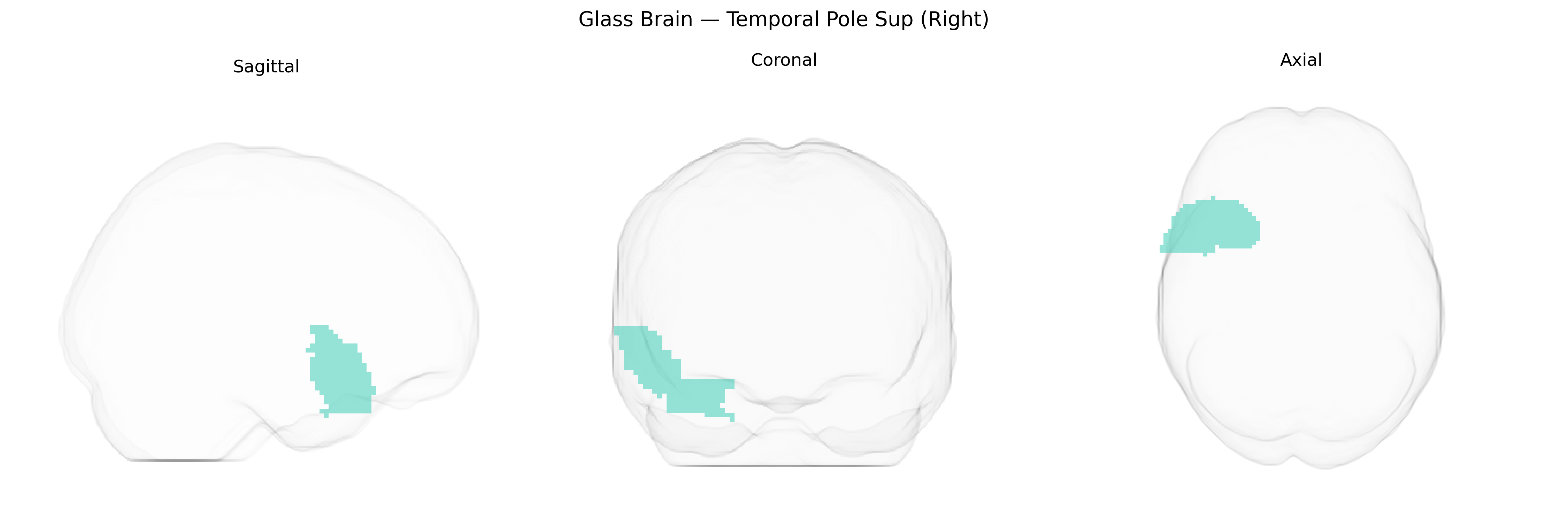 Triplanar Ghost Brain