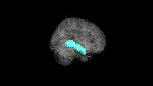 Full Brain Black