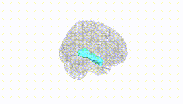 Full Brain White