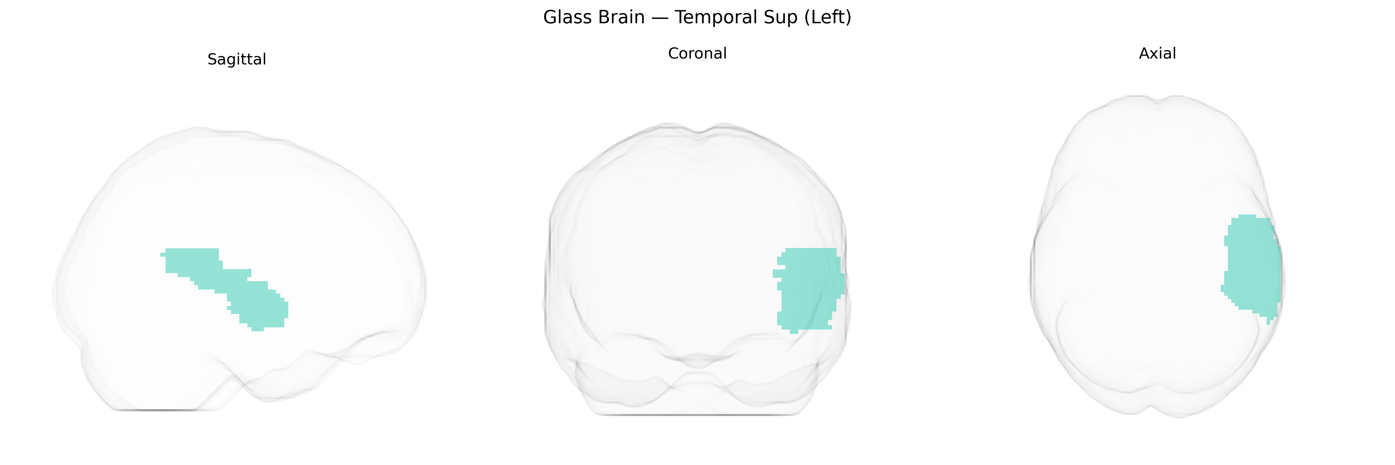 Triplanar Ghost Brain