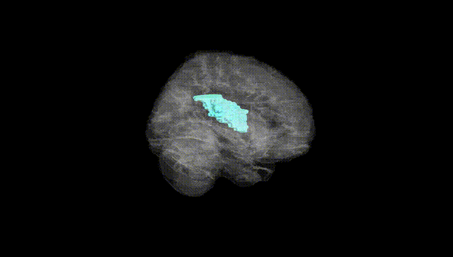 Full Brain Black