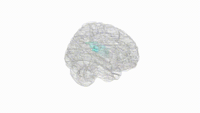 Full Brain White
