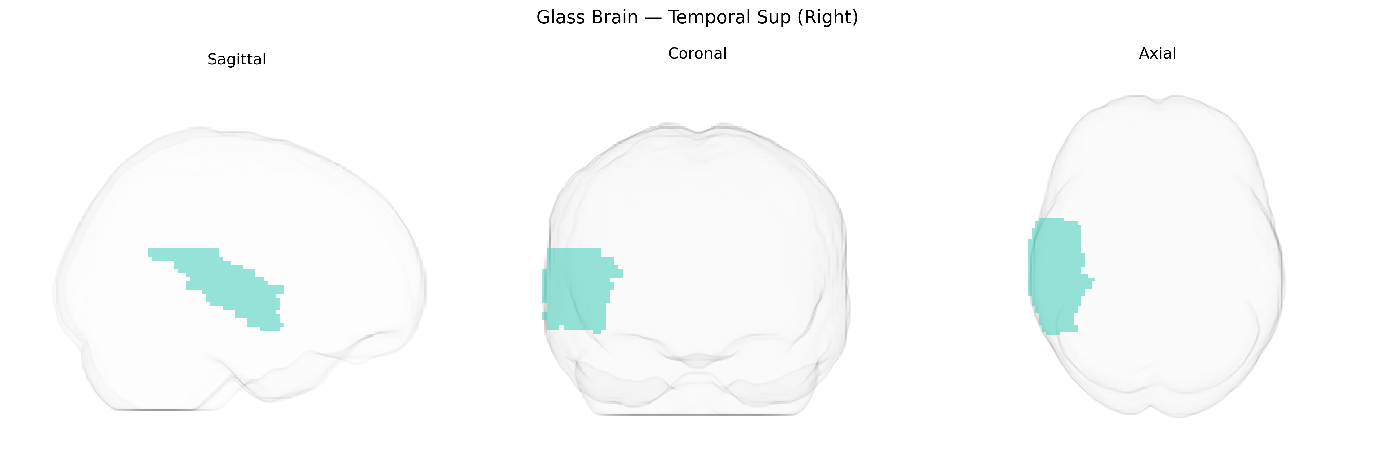 Triplanar Ghost Brain