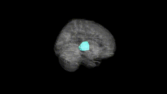 Full Brain Black