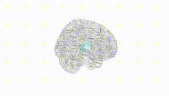 Full Brain White