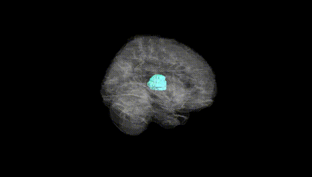Full Brain Black