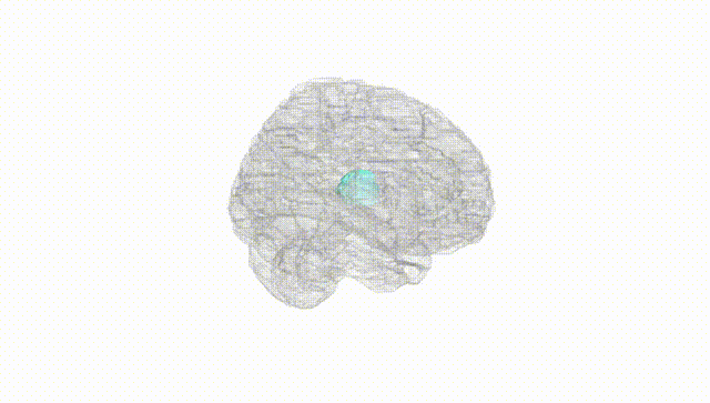 Full Brain White