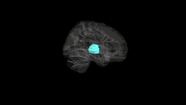 Hemisphere Black