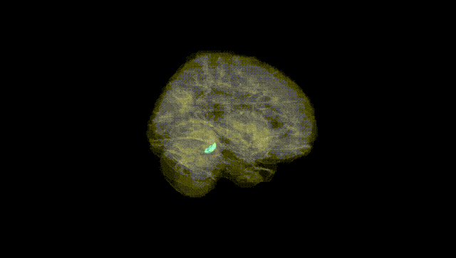 Full Brain Black