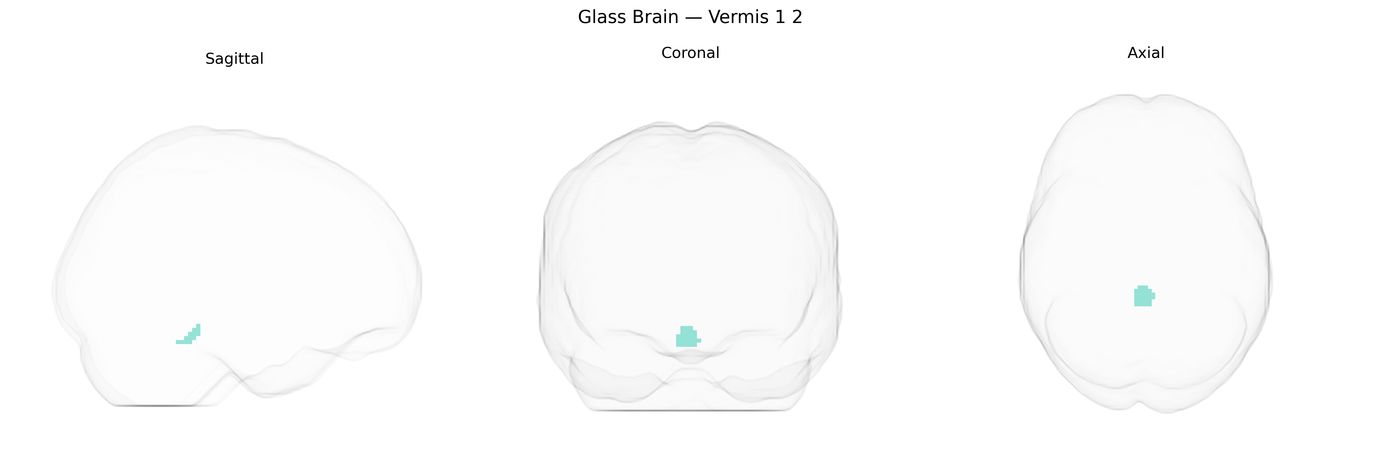 Triplanar Ghost Brain