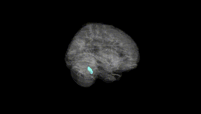 Full Brain Black