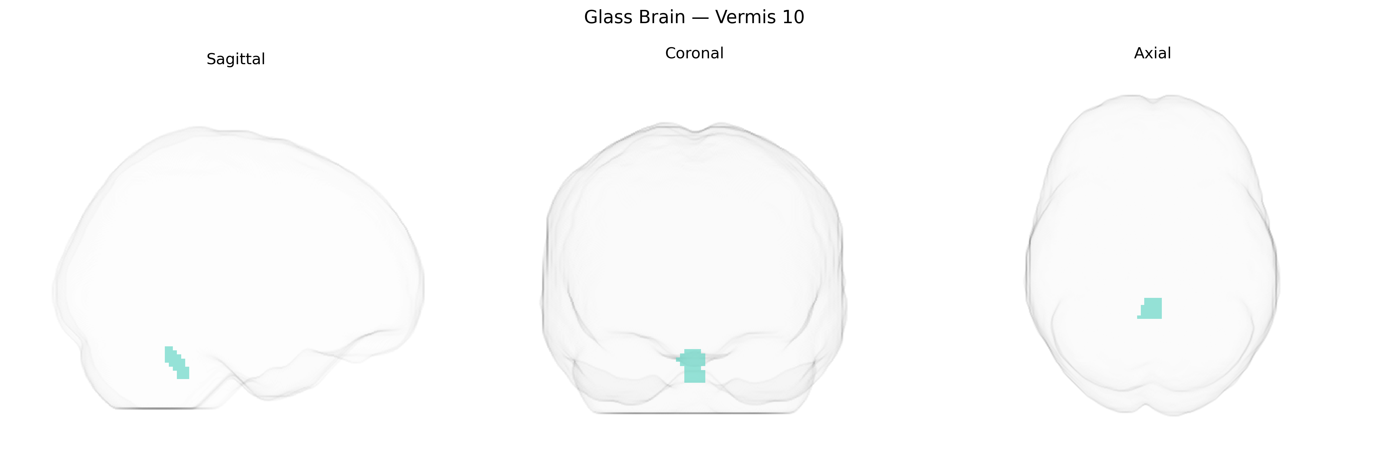 Triplanar Ghost Brain