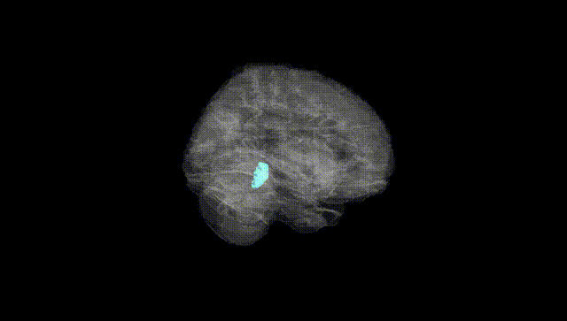 Full Brain Black