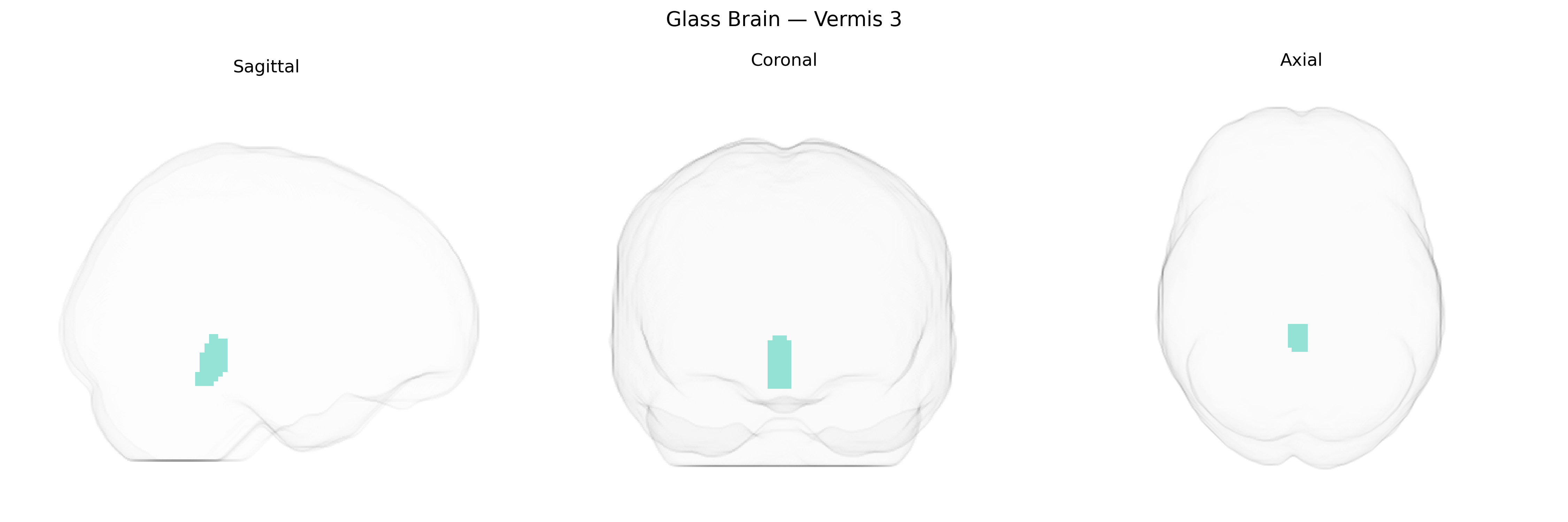 Triplanar Ghost Brain