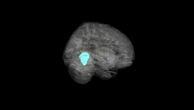 Full Brain Black