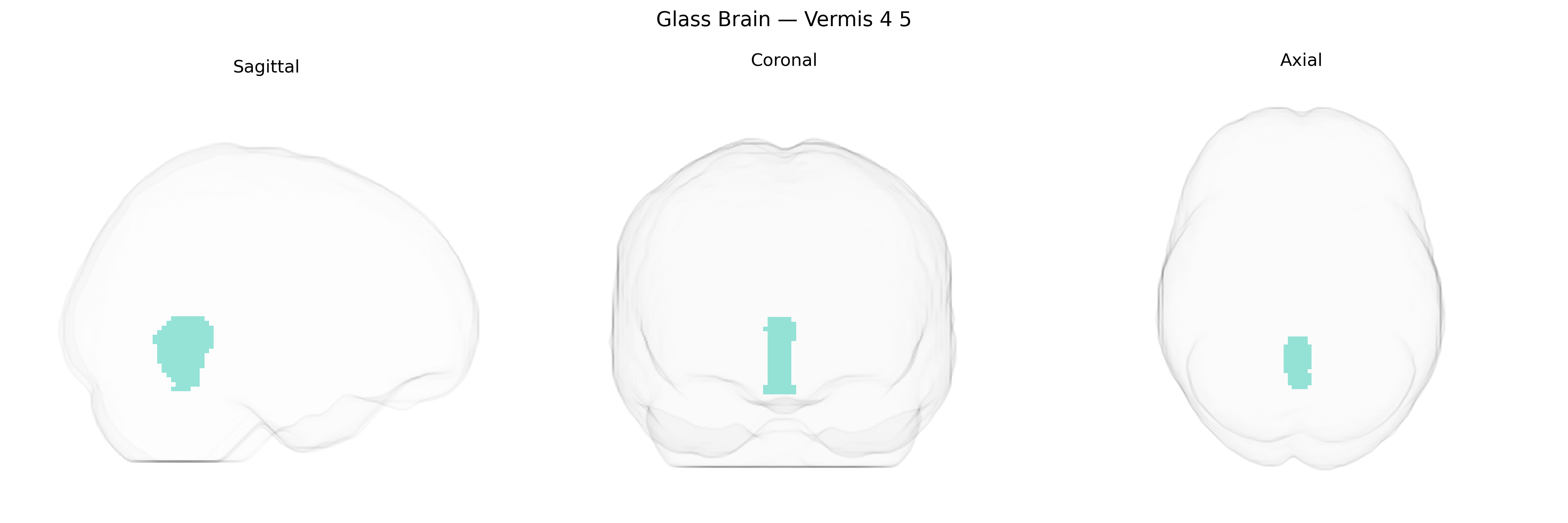 Triplanar Ghost Brain